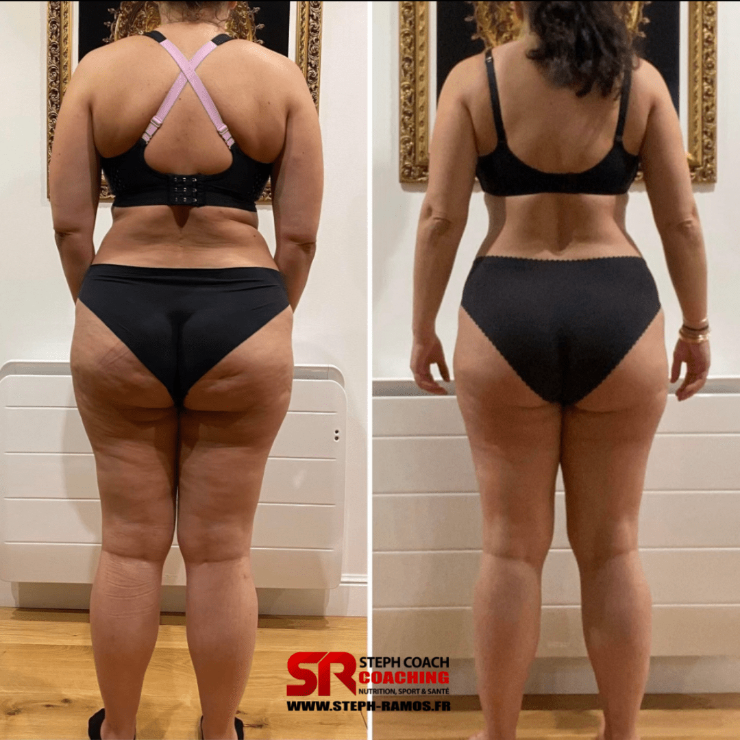 Perte de poids & cellulite (maladie coeliaque) 86 kg — en cours : 79 kg — 3 mois